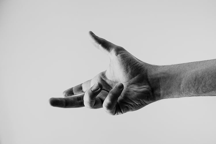 117 arm pain chiropractic treatment Trigger Finger