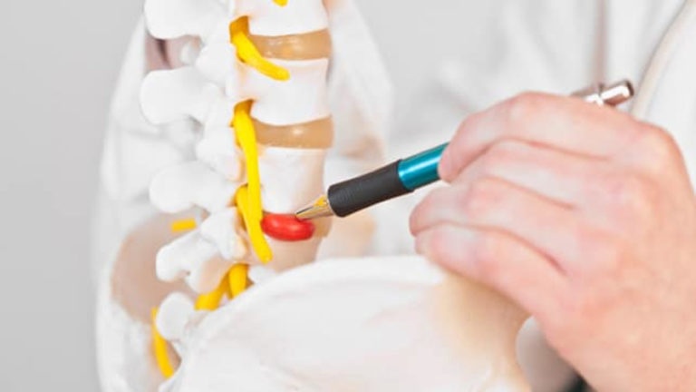 17 back pain chiropractic treatment Herniated Disc Recovery